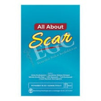Image of All About Scar